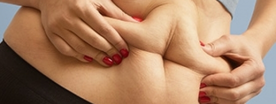 Canetas emagrecedoras causam flacidez? Saiba como evitar